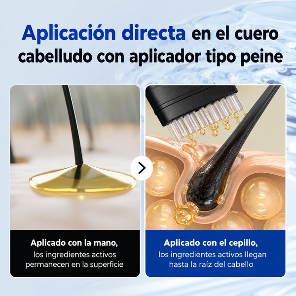 EPAIS - Suero para el cabello, reduce la caspa y las escamas